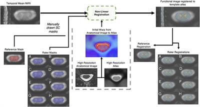 Effects of variability in manually contoured spinal cord masks on fMRI co-registration and interpretation